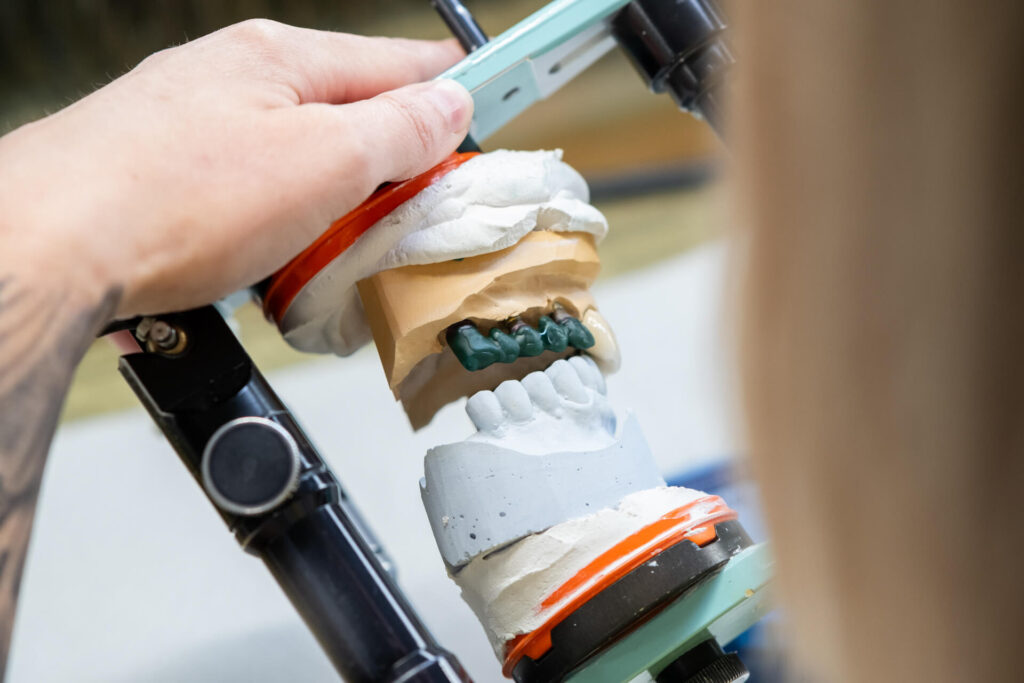 HUB Dental Technik-5643